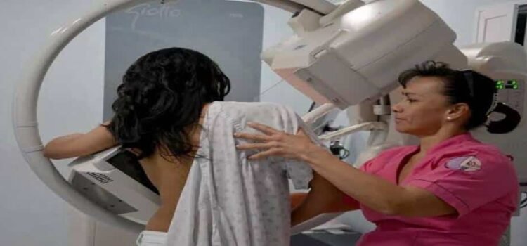 Realizará SSM mastografías gratuitas en 8 municipios