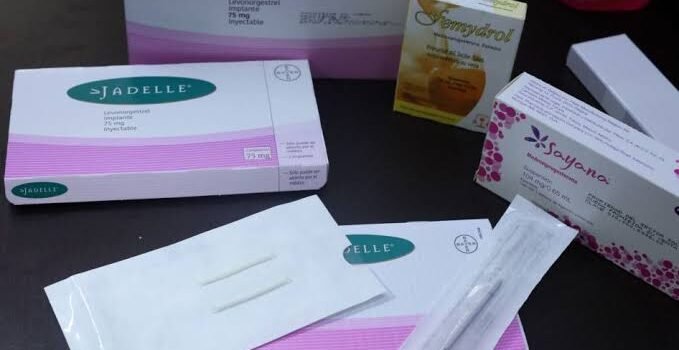 SSM ofrecerá implantes anticonceptivos gratuitos en Zamora SSM ofrecerá implantes anticonceptivos gratuitos en Zamora